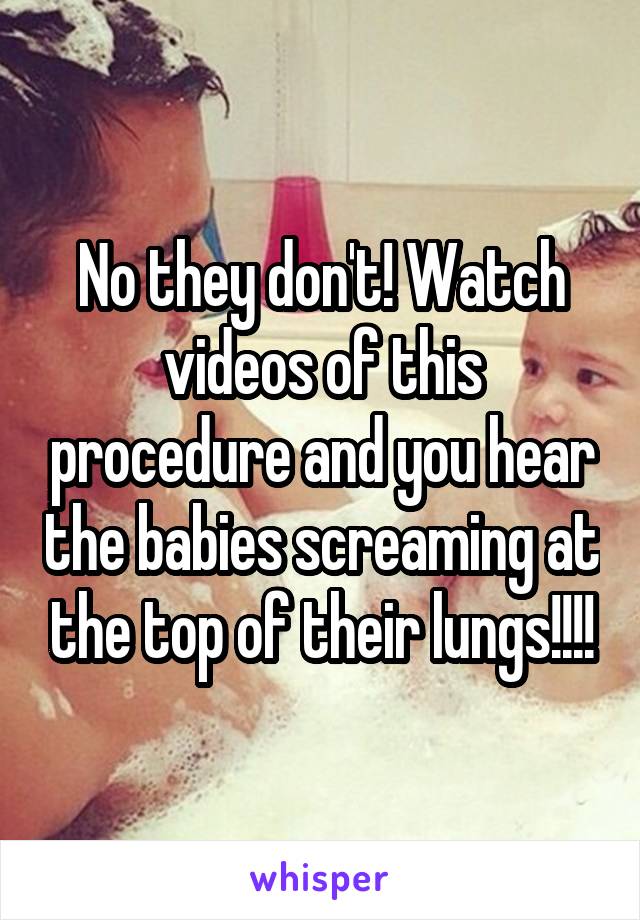 No they don't! Watch videos of this procedure and you hear the babies screaming at the top of their lungs!!!!