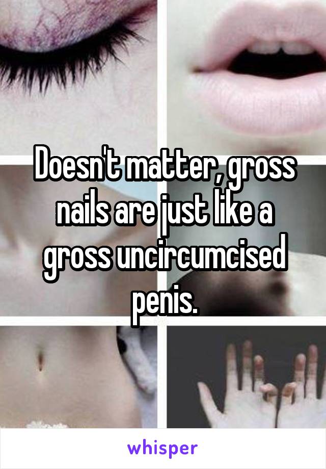 Doesn't matter, gross nails are just like a gross uncircumcised penis.