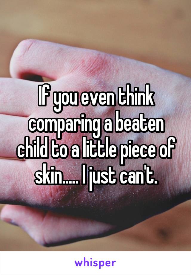 If you even think comparing a beaten child to a little piece of skin..... I just can't.