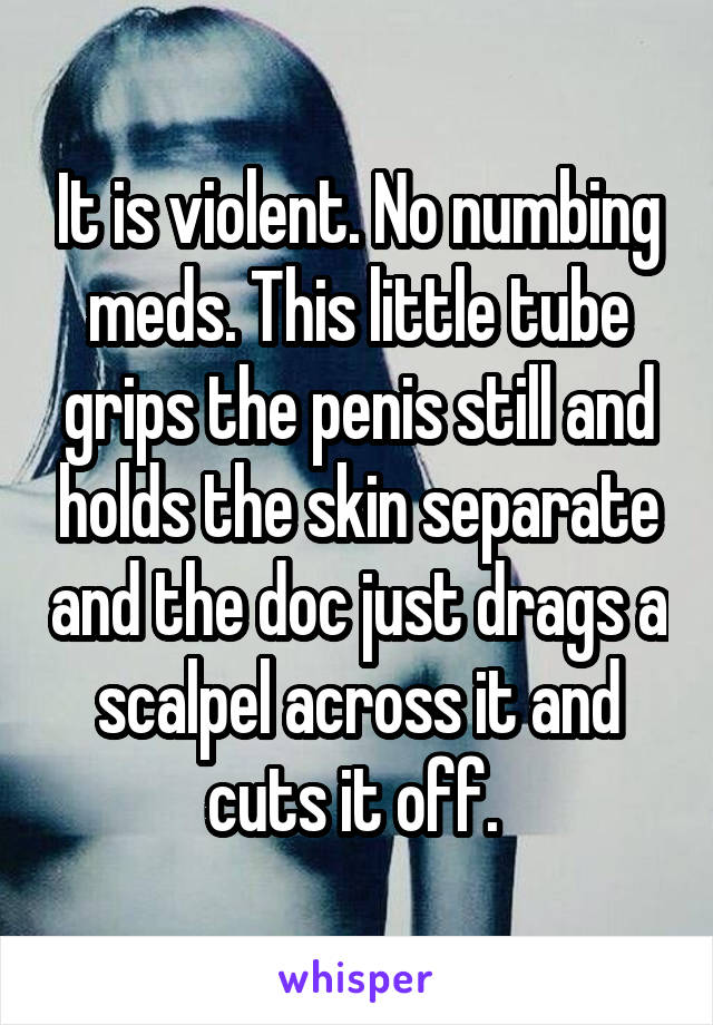 It is violent. No numbing meds. This little tube grips the penis still and holds the skin separate and the doc just drags a scalpel across it and cuts it off. 