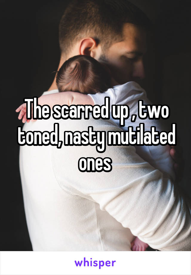 The scarred up , two toned, nasty mutilated ones 