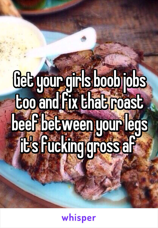 Get your girls boob jobs too and fix that roast beef between your legs it's fucking gross af 