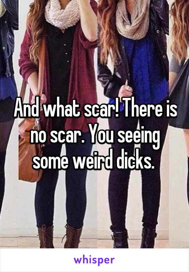 And what scar! There is no scar. You seeing some weird dicks. 