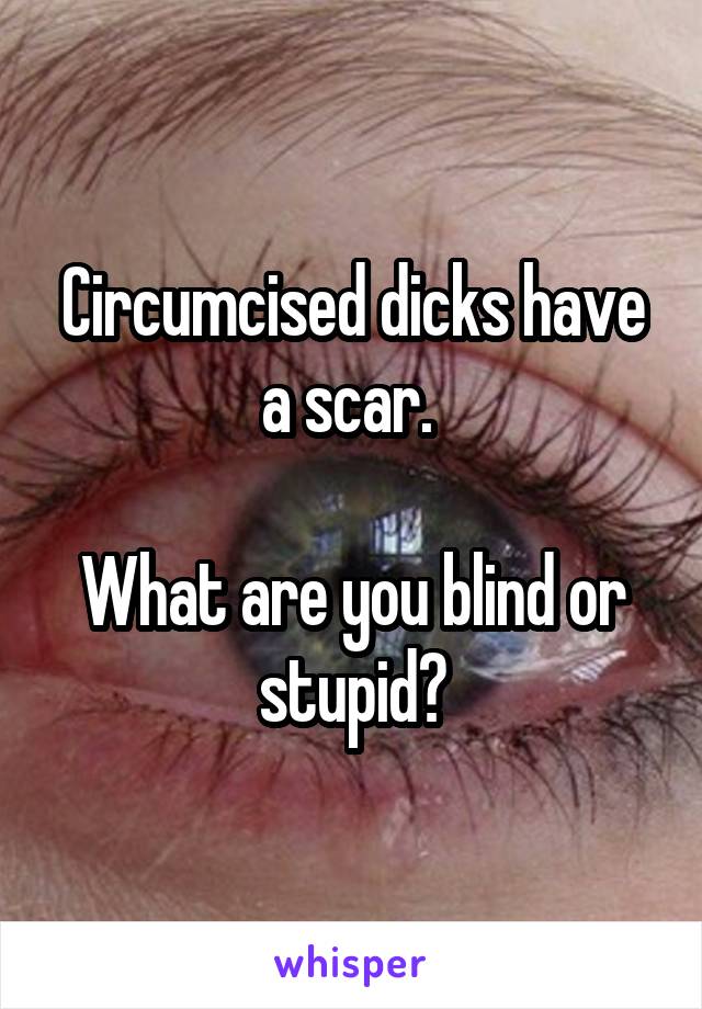 Circumcised dicks have a scar. 

What are you blind or stupid?