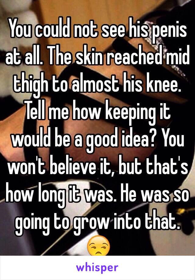 You could not see his penis at all. The skin reached mid thigh to almost his knee. Tell me how keeping it would be a good idea? You won't believe it, but that's how long it was. He was so going to grow into that. 😒