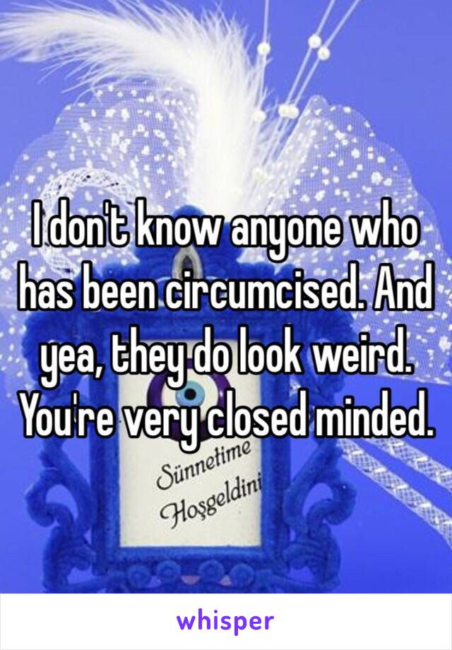 I don't know anyone who has been circumcised. And yea, they do look weird. You're very closed minded. 