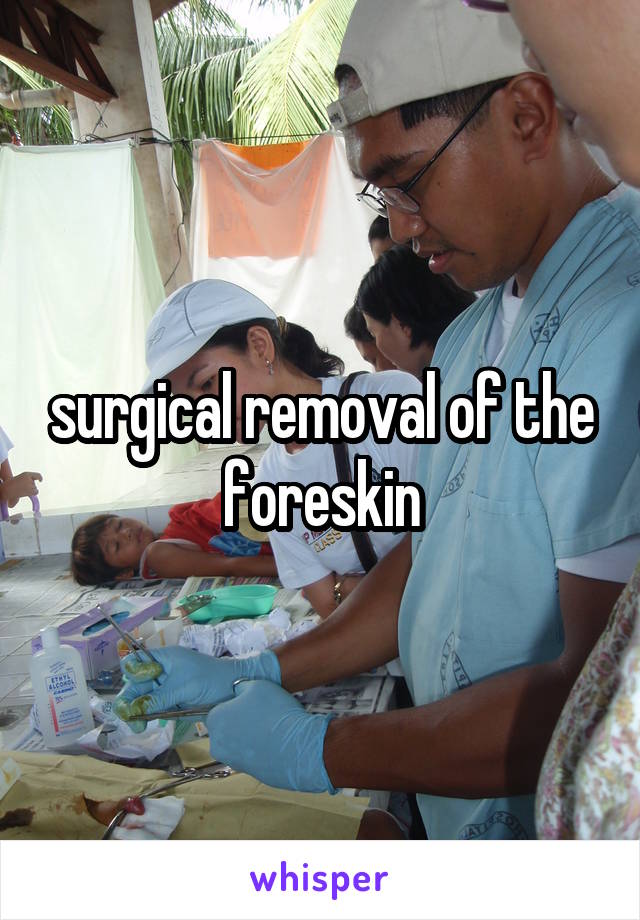 surgical removal of the foreskin