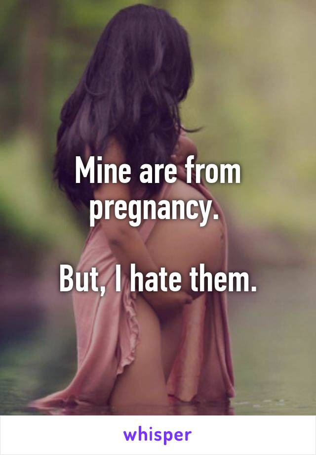 Mine are from pregnancy. 

But, I hate them.
