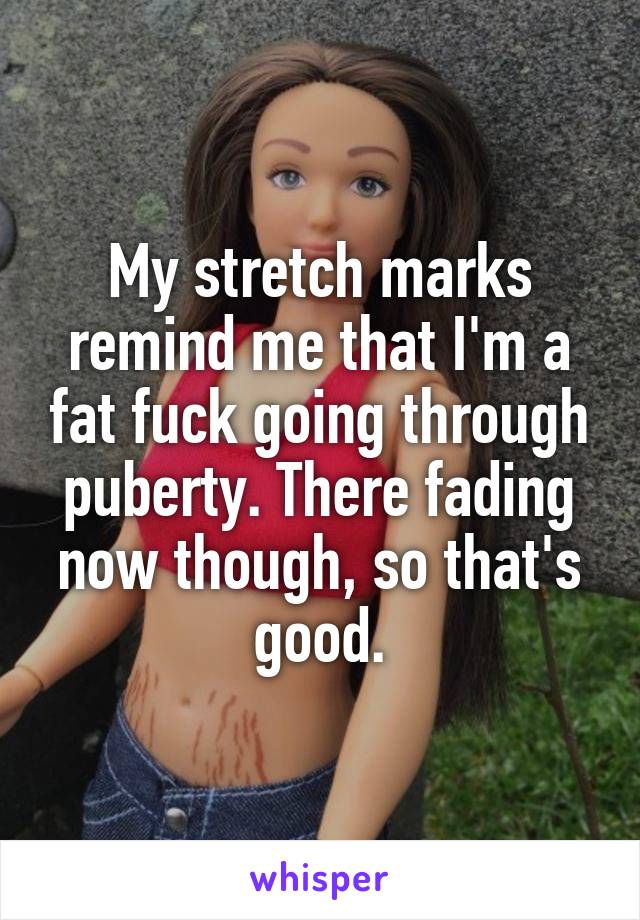 My stretch marks remind me that I'm a fat fuck going through puberty. There fading now though, so that's good.