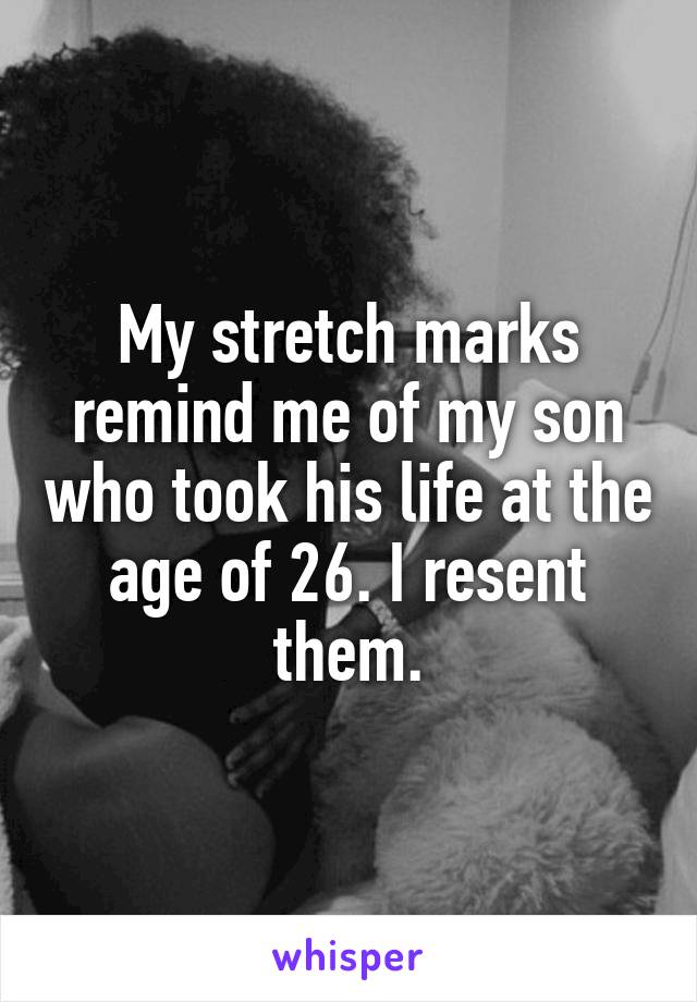 My stretch marks remind me of my son who took his life at the age of 26. I resent them.
