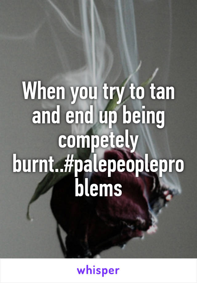 When you try to tan and end up being competely burnt..#palepeopleproblems
