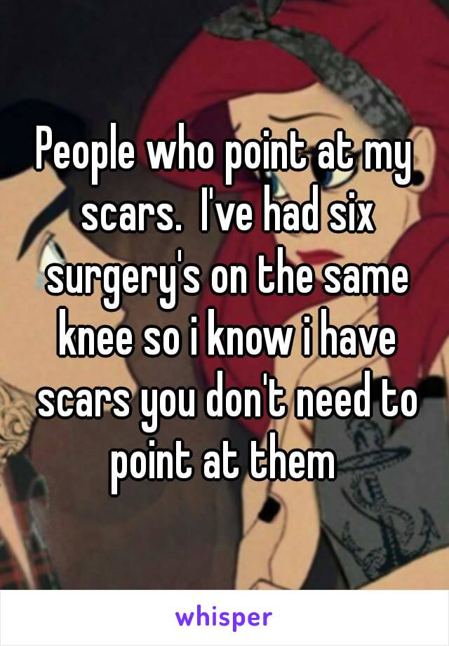 People who point at my scars.  I've had six surgery's on the same knee so i know i have scars you don't need to point at them 
