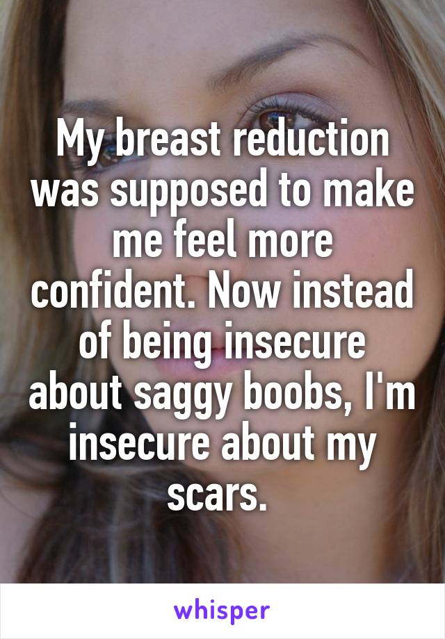 My breast reduction was supposed to make me feel more confident. Now instead of being insecure about saggy boobs, I'm insecure about my scars. 