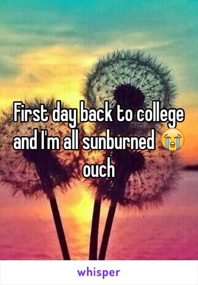 First day back to college and I'm all sunburned 😭ouch 