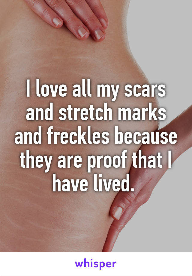 I love all my scars and stretch marks and freckles because they are proof that I have lived. 