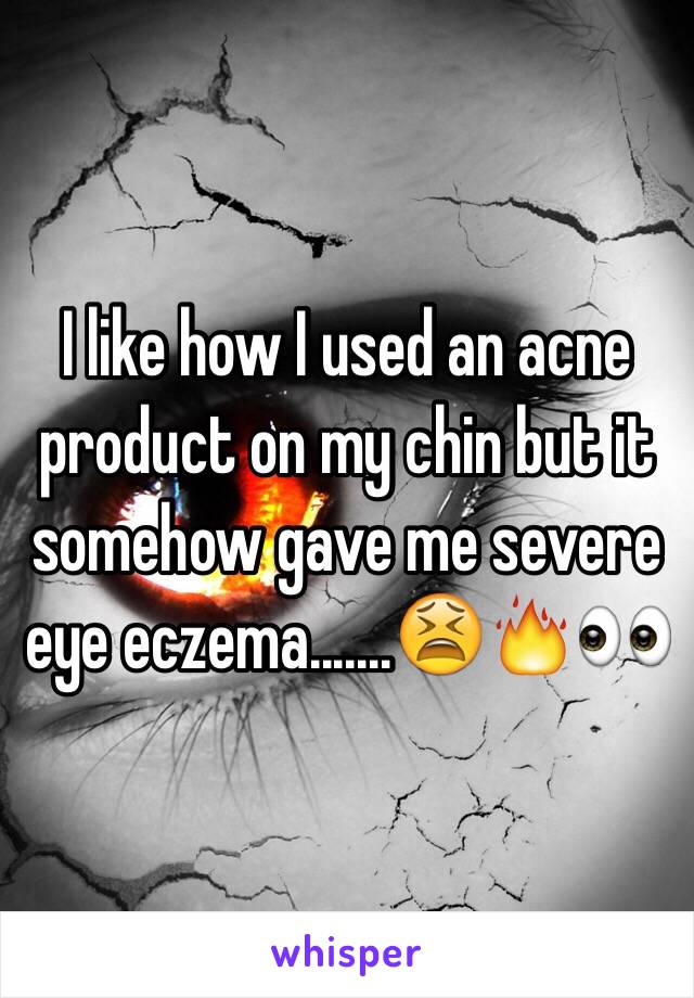 I like how I used an acne product on my chin but it somehow gave me severe eye eczema.......😫🔥👀