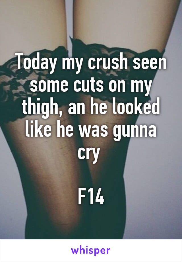 Today my crush seen some cuts on my thigh, an he looked like he was gunna cry 

F14