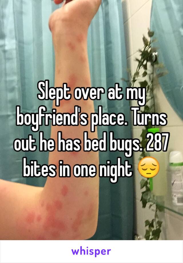Slept over at my boyfriend's place. Turns out he has bed bugs. 287 bites in one night 😔