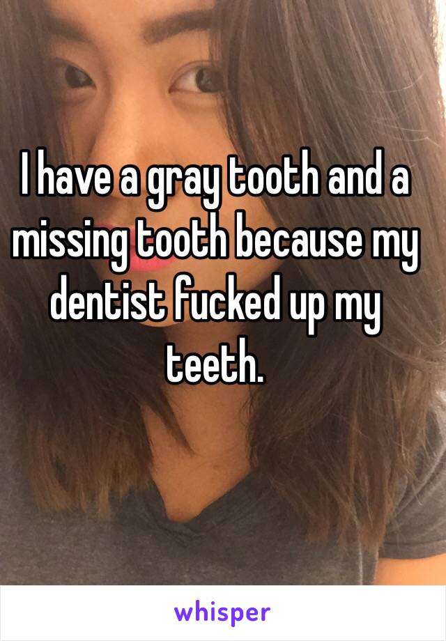 I have a gray tooth and a missing tooth because my dentist fucked up my teeth. 