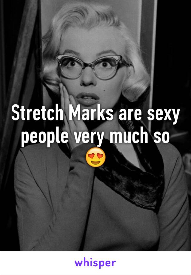 Stretch Marks are sexy people very much so 😍