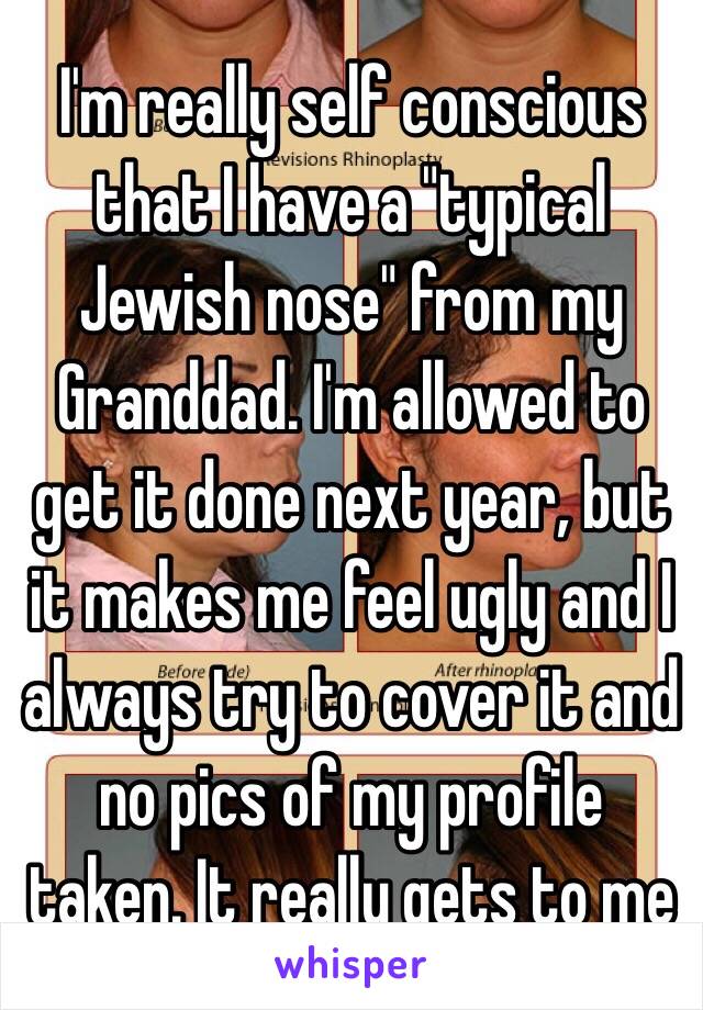 I'm really self conscious that I have a "typical Jewish nose" from my Granddad. I'm allowed to get it done next year, but it makes me feel ugly and I always try to cover it and no pics of my profile taken. It really gets to me