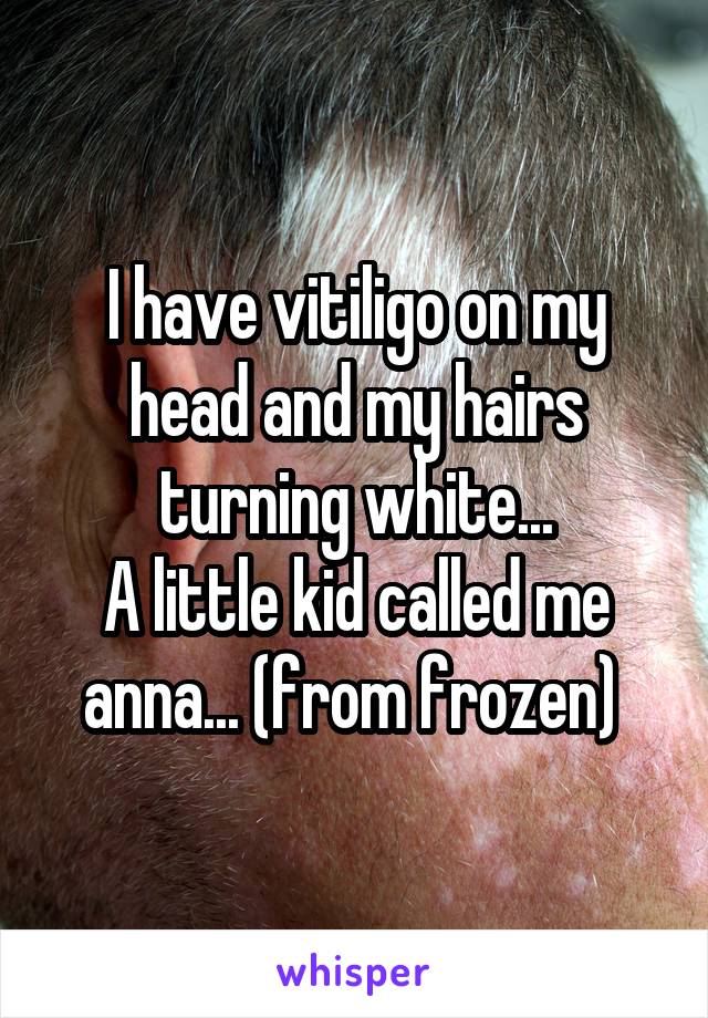I have vitiligo on my head and my hairs turning white...
A little kid called me anna... (from frozen) 