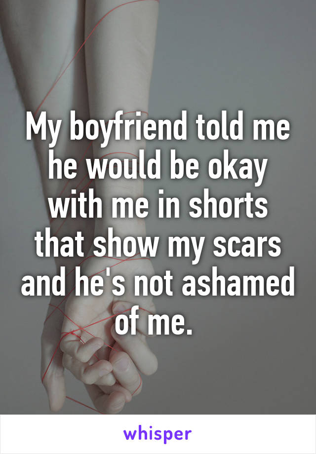 My boyfriend told me he would be okay with me in shorts that show my scars and he's not ashamed of me. 