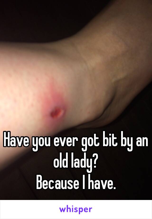 Have you ever got bit by an old lady? 
Because I have. 