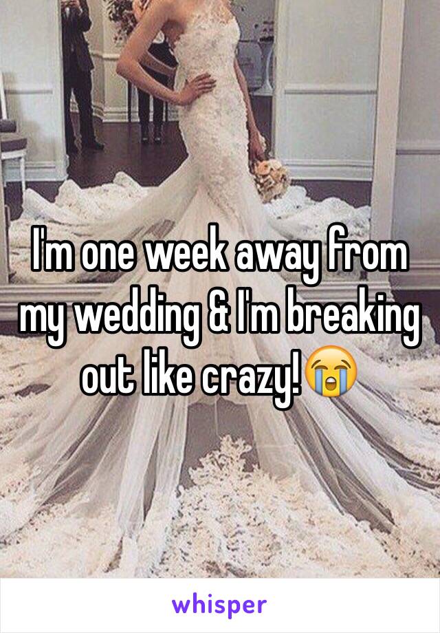 I'm one week away from my wedding & I'm breaking out like crazy!😭