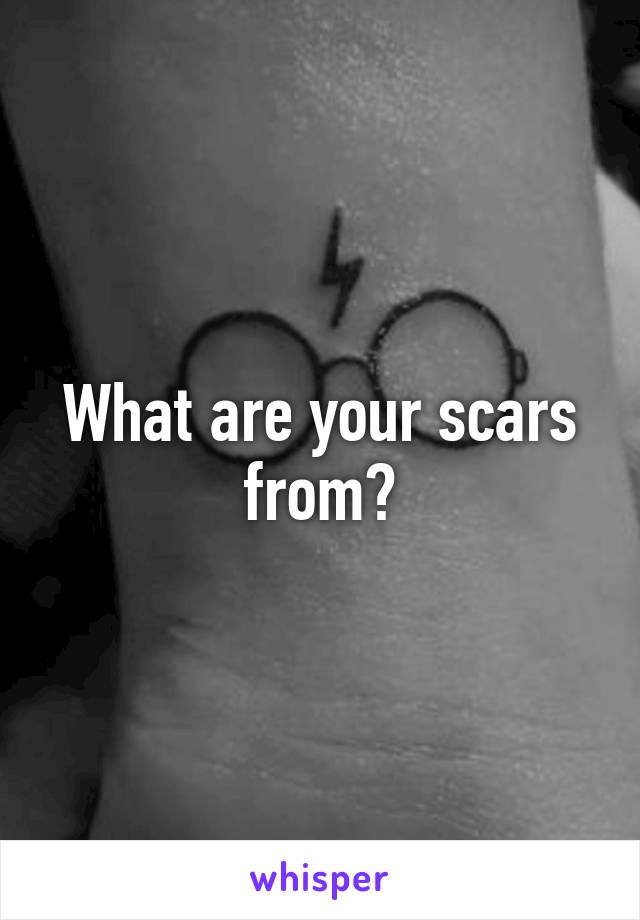 What are your scars from?