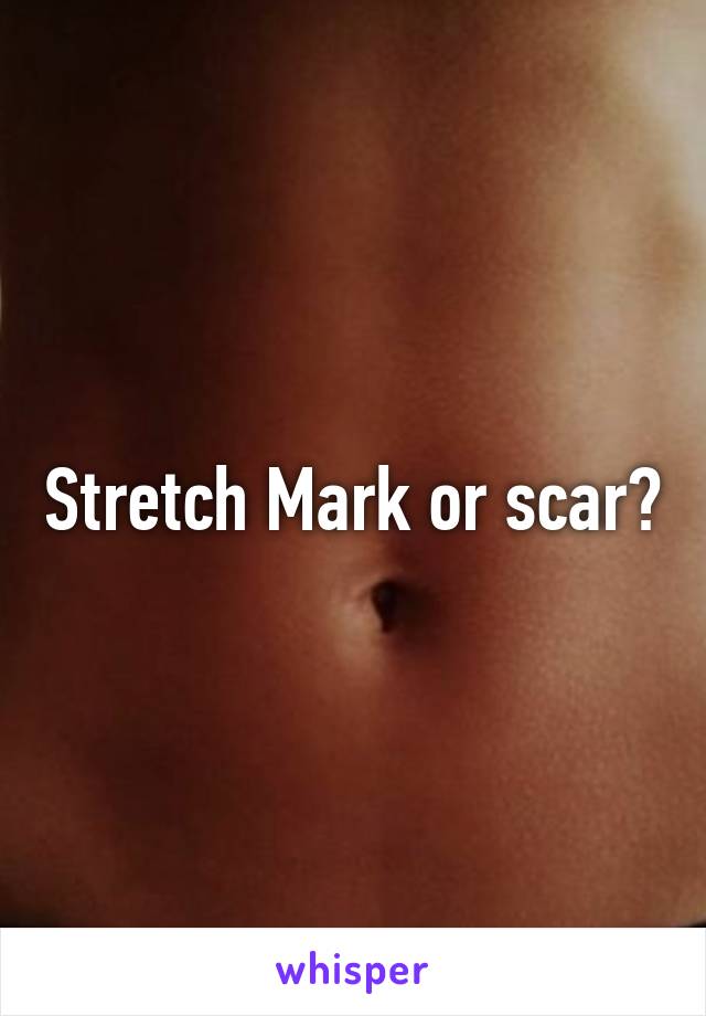 Stretch Mark or scar?