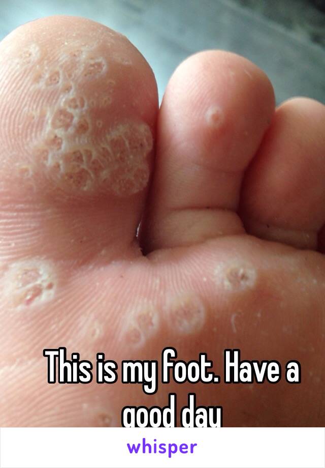 This is my foot. Have a good day