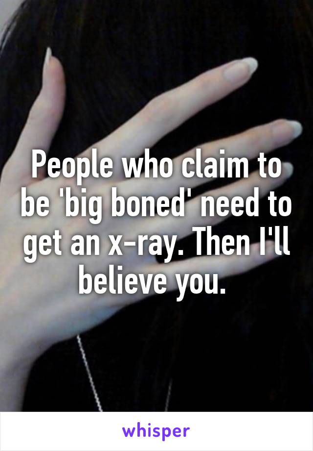 People who claim to be 'big boned' need to get an x-ray. Then I'll believe you. 