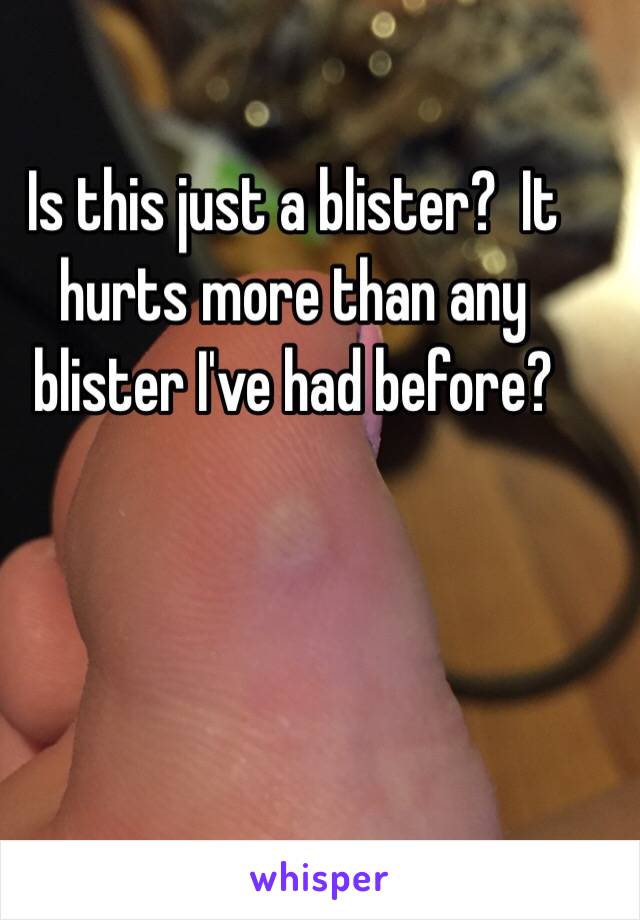 Is this just a blister?  It hurts more than any blister I've had before?