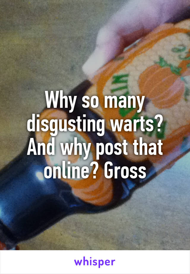 Why so many disgusting warts? And why post that online? Gross