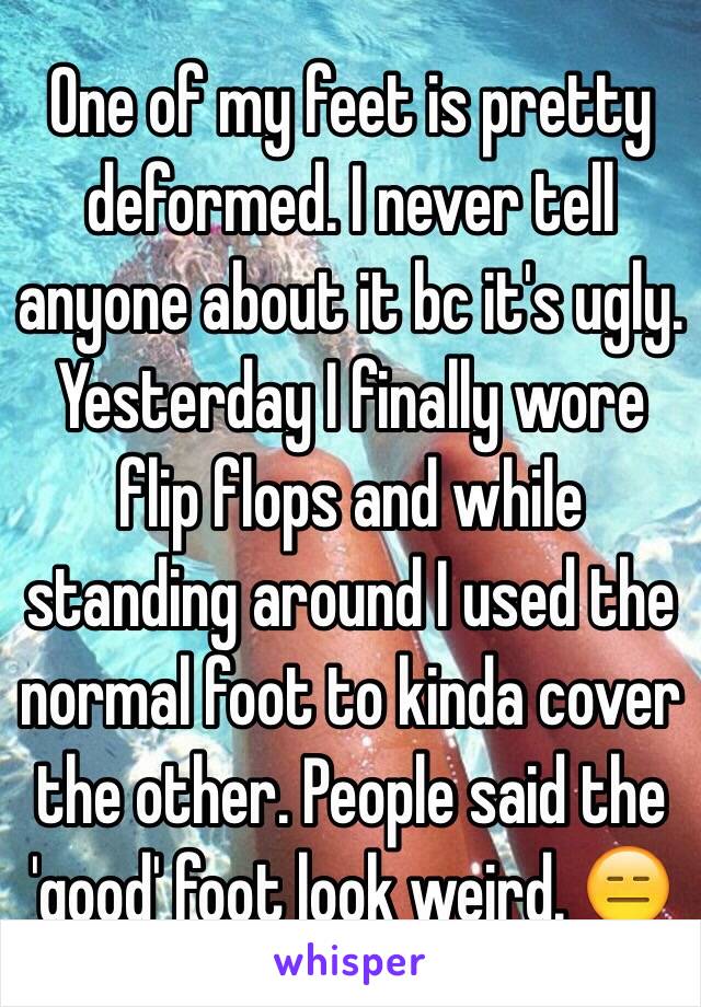 One of my feet is pretty deformed. I never tell anyone about it bc it's ugly. Yesterday I finally wore flip flops and while standing around I used the normal foot to kinda cover the other. People said the 'good' foot look weird. 😑