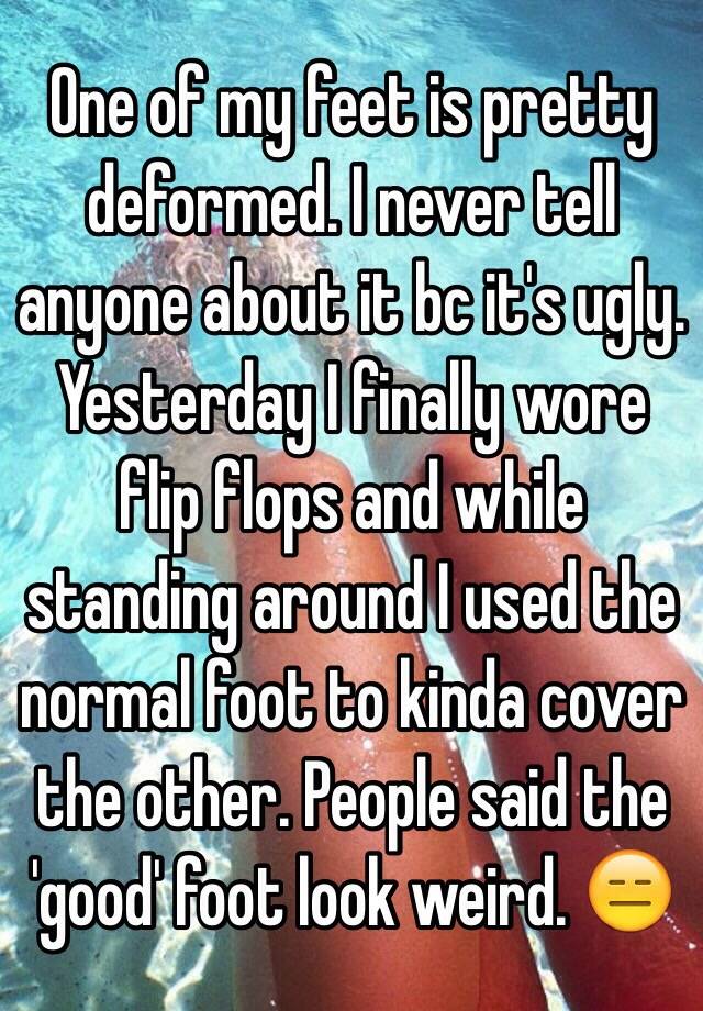 One of my feet is pretty deformed. I never tell anyone about it bc it's ugly. Yesterday I finally wore flip flops and while standing around I used the normal foot to kinda cover the other. People said the 'good' foot look weird. 😑