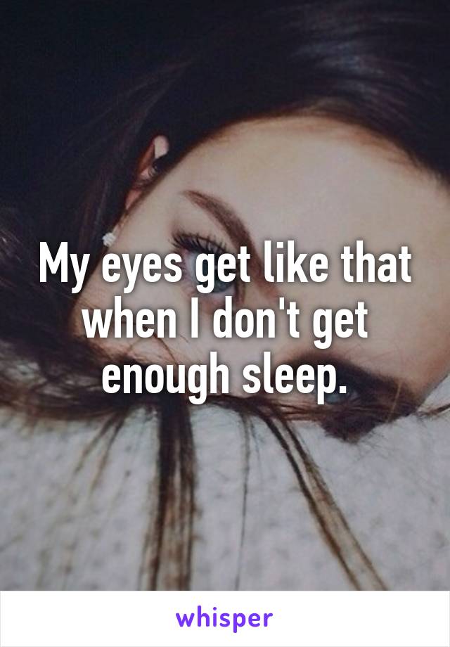 My eyes get like that when I don't get enough sleep.