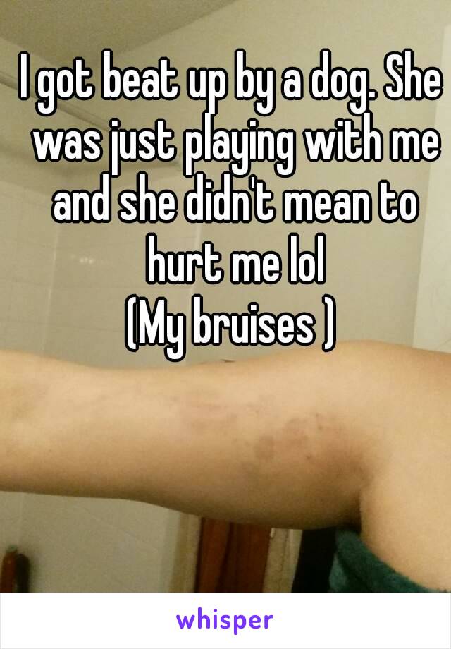 I got beat up by a dog. She was just playing with me and she didn't mean to hurt me lol
(My bruises )