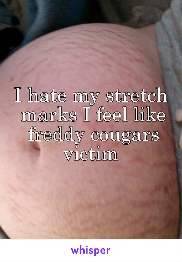 I hate my stretch marks I feel like freddy cougars victim 