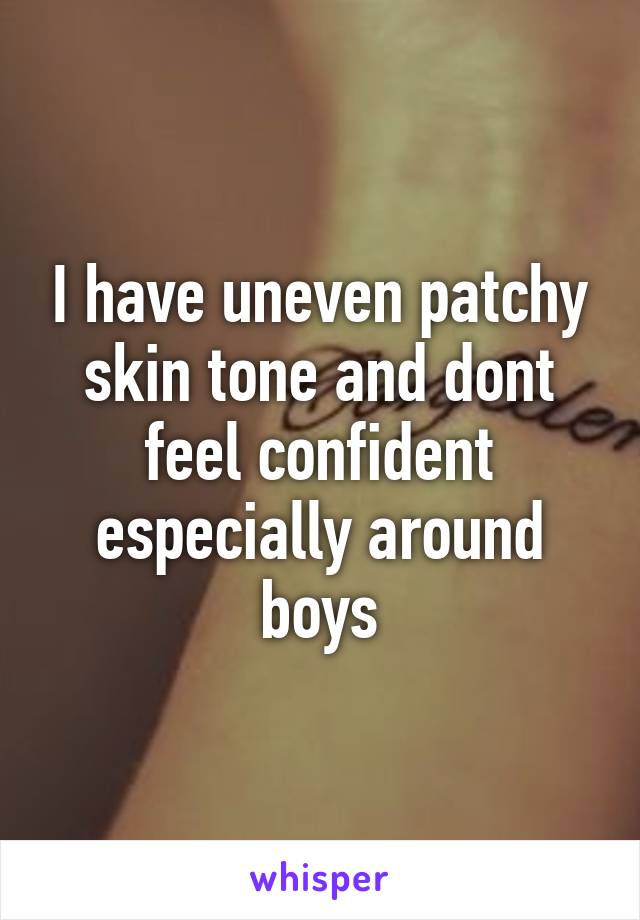 I have uneven patchy skin tone and dont feel confident especially around boys