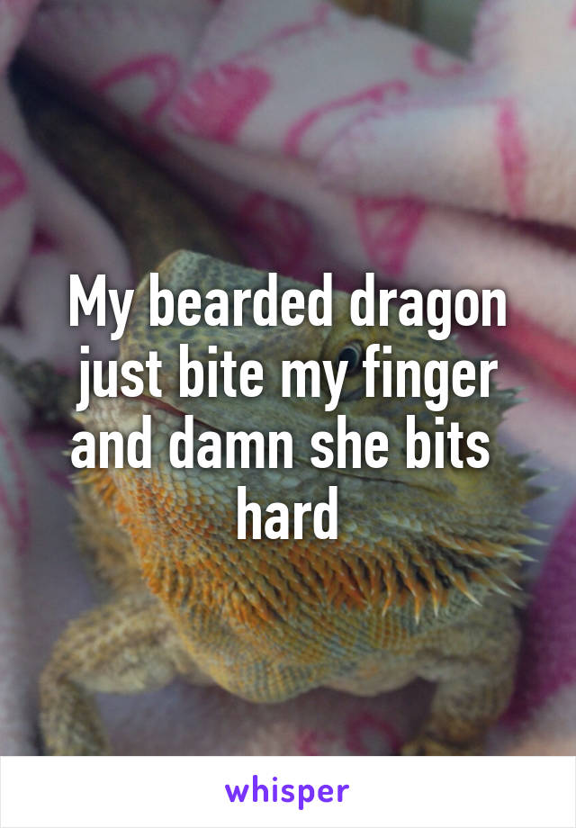 My bearded dragon just bite my finger and damn she bits  hard