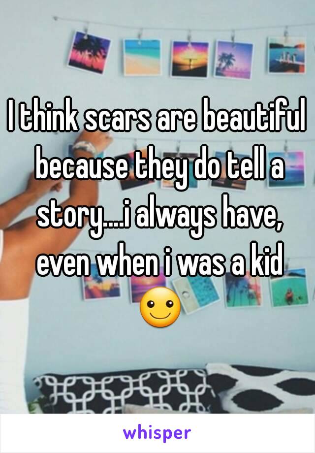 I think scars are beautiful because they do tell a story....i always have, even when i was a kid ☺