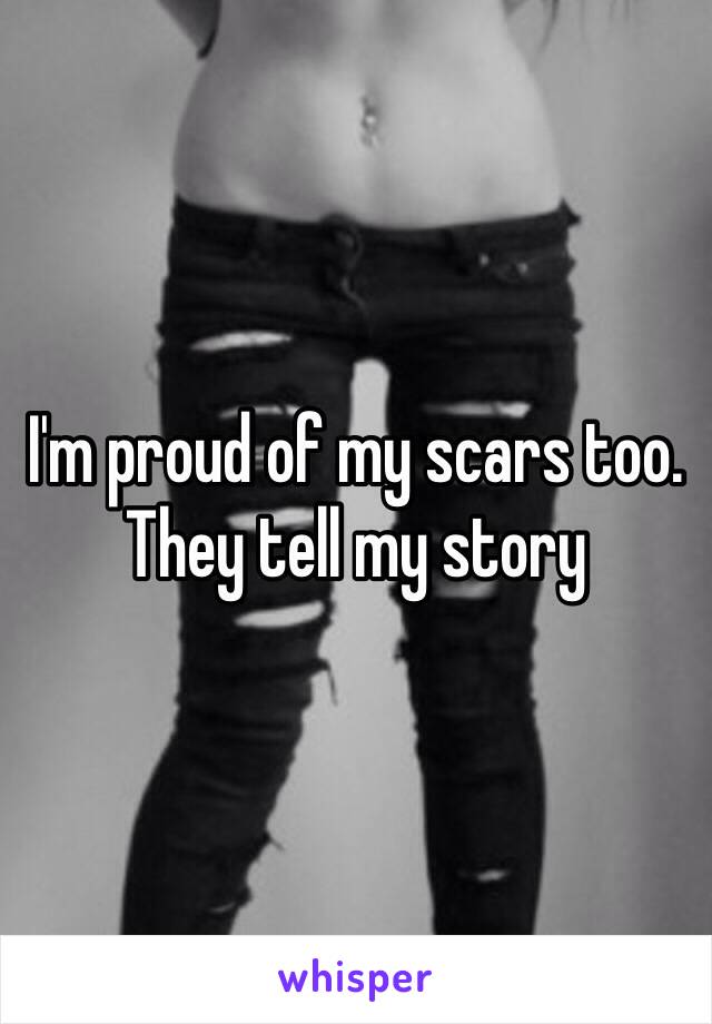 I'm proud of my scars too. They tell my story 