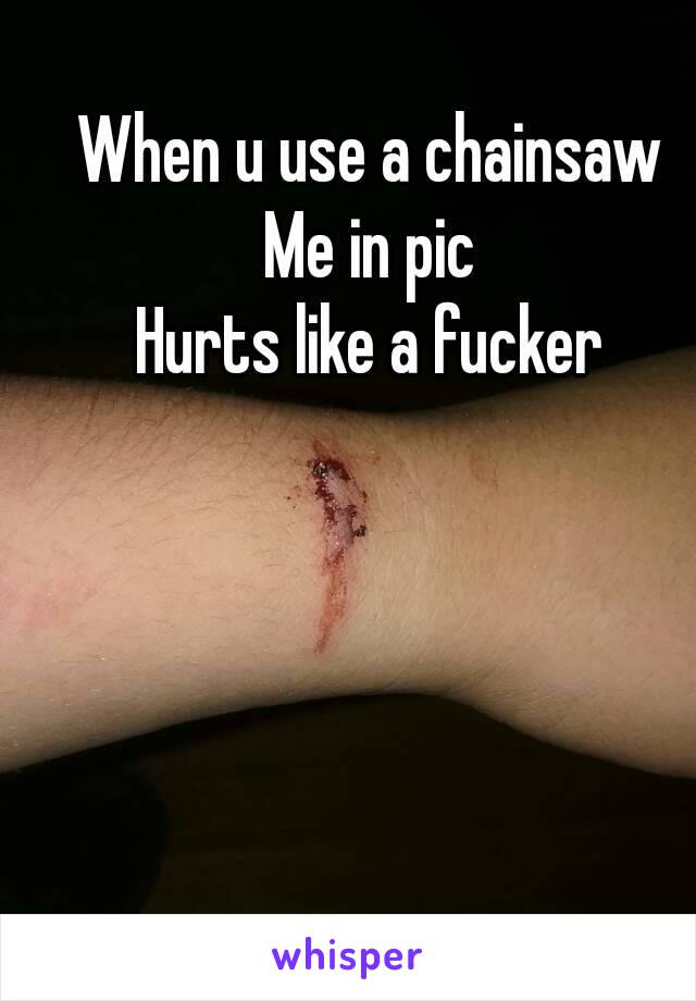 When u use a chainsaw
Me in pic
Hurts like a fucker