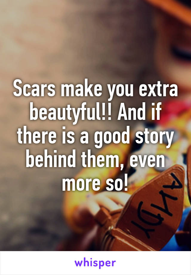 Scars make you extra beautyful!! And if there is a good story behind them, even more so!