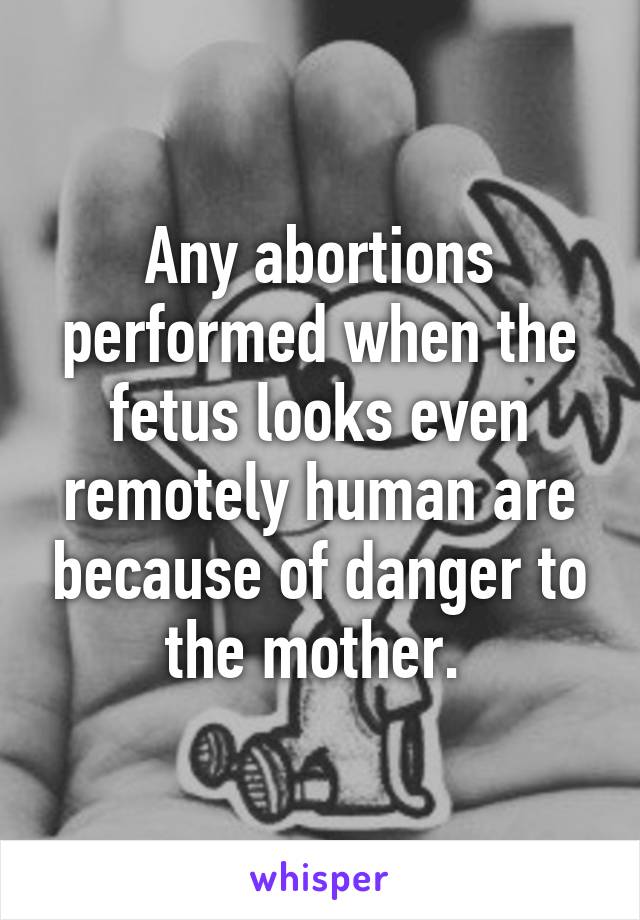 Any abortions performed when the fetus looks even remotely human are because of danger to the mother. 