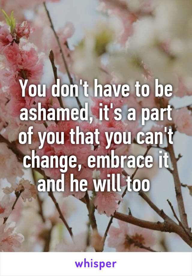 You don't have to be ashamed, it's a part of you that you can't change, embrace it and he will too 