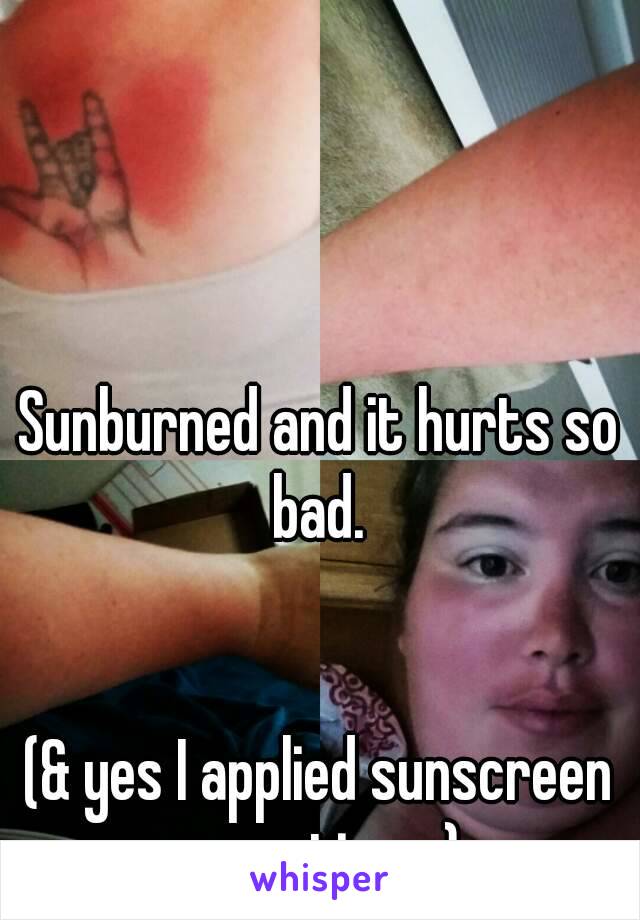 Sunburned and it hurts so bad. 


(& yes I applied sunscreen many times) 

