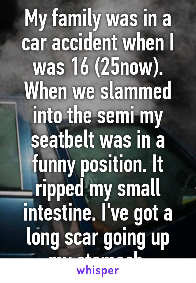 My family was in a car accident when I was 16 (25now). When we slammed into the semi my seatbelt was in a funny position. It ripped my small intestine. I've got a long scar going up my stomach.